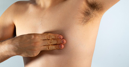 Male Breast Problems